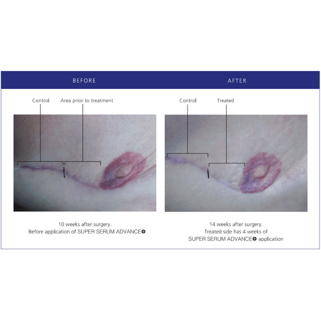 iS Clinical Super Serum Advance+ 30ml