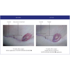 iS Clinical Super Serum Advance+ 30ml